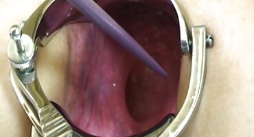 കൊഴുപ്പ് എബണി അവളുടെ സുഹൃത്തിനെ പുറത്താക്കി കാമുകനോടൊപ്പം ഫംഗസ് തുടങ്ങി